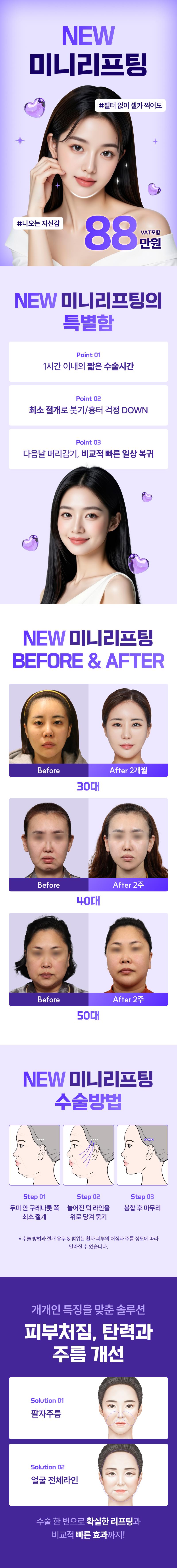 리팅성형외과의원 강남점에서 제공하는 확실한 V라인 미니리프팅 시술은 보정 없이 매끈한 브이라인을 만들어 드립니다.