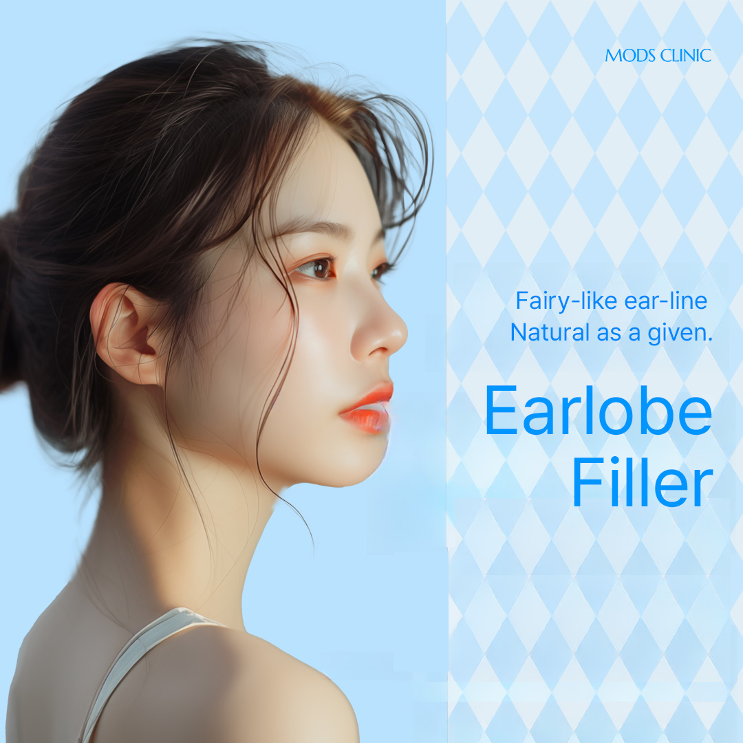 Cheongdam Mods Elf Ear Filler