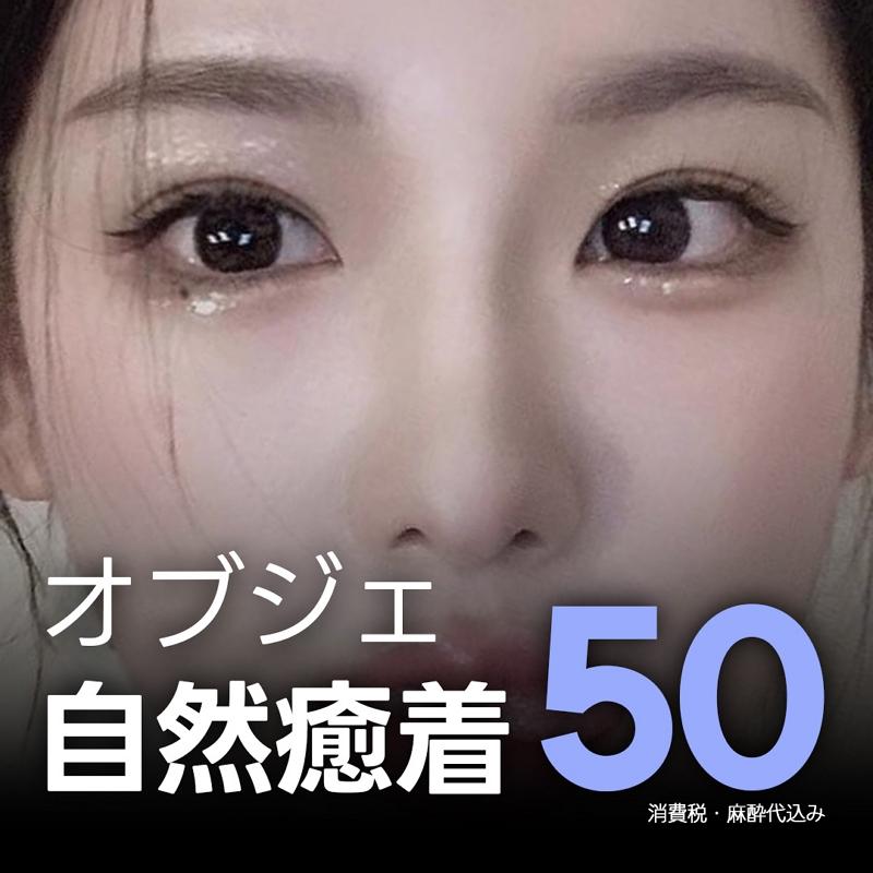 オブジェの自然癒着