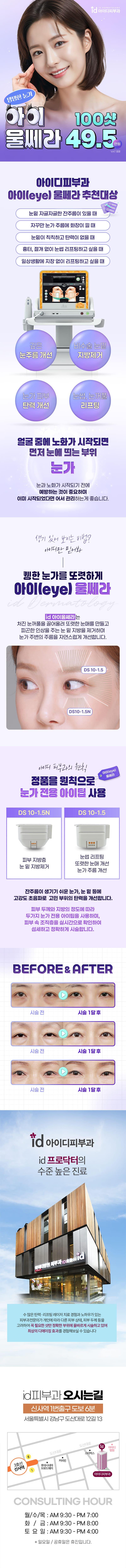 서울 신사에 위치한 아이디피부과의원의 '아이울쎄라(eye)' 시술은 눈가 주름 리프팅, 아이리쥬란, 아이울쎄라(아이팁)로 눈가를 또렷하게 만들어 주는 특징을 가지고 있습니다.