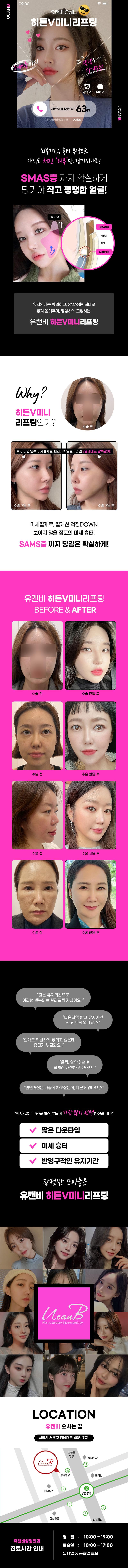 SMAS층 리프팅으로 확실한 V라인 윤곽을 만드는 히든V 미니리프팅 시술