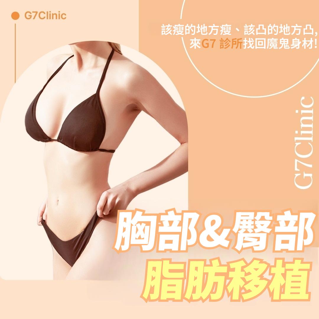 G7脂肪移植