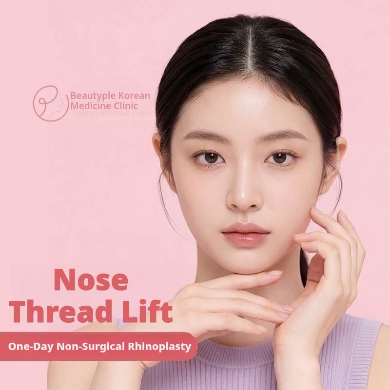 Nose Thread Lifting 6p (One-Day, Non-Surgical)