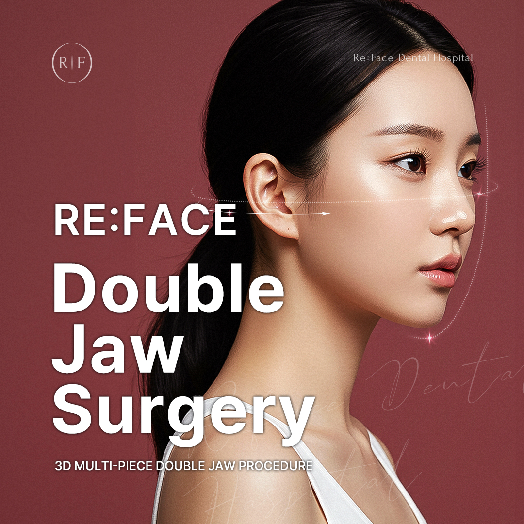 Reface 3D Double Jaw Surgery