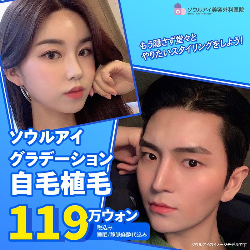 ナチュラルグラデーション自毛植毛