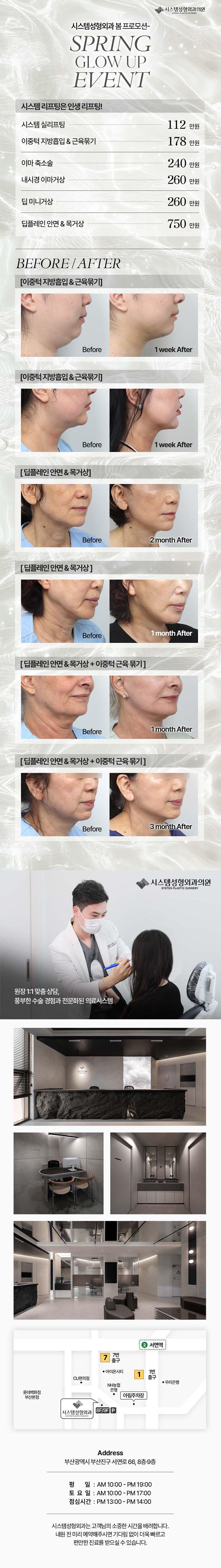 부산 서면 시스템성형외과의원의 시스템 인생 리프팅 거상 시술은 실리프팅부터 거상까지 112만원에 제공합니다.