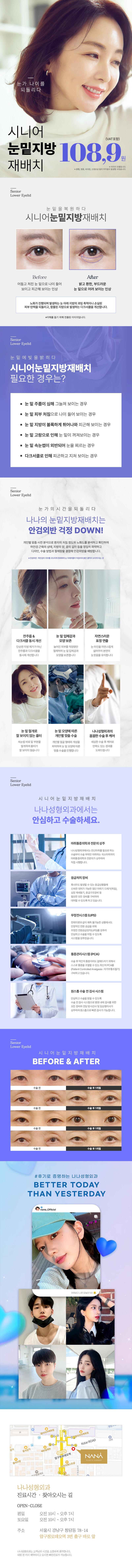 서울 압구정에 위치한 나나성형외과의원에서 제공하는 시니어 눈밑지방재배치 서비스는 노화를 멈추고 어둡고 처진 눈밑에 생기를 더하는 특별한 성형 솔루션입니다.