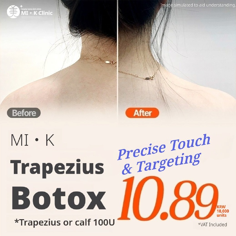 MI.K Trapezius & Calf Botox 100U