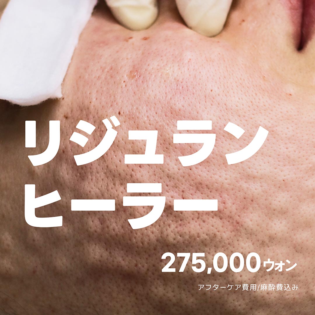 リジュランヒーラー_肌診断, 痛みケア, 鎮静ケア込み