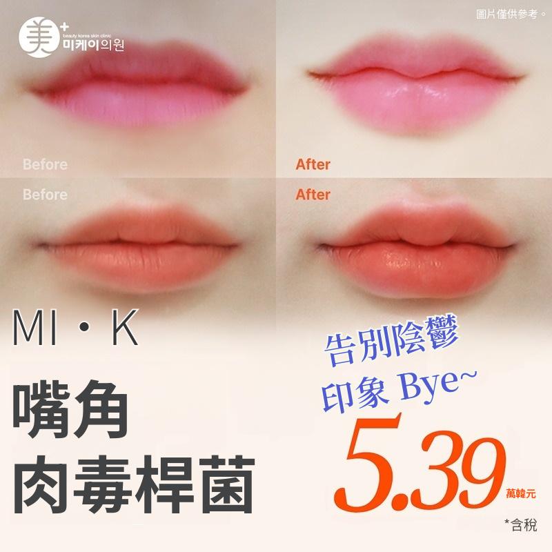 果汁感滿滿_嘴角肉毒桿菌