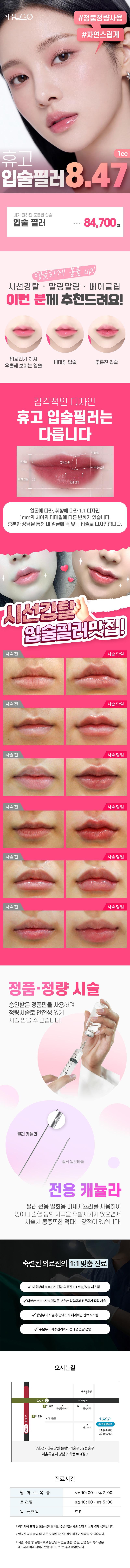 서울 논현에 위치한 휴고성형외과의원의 휴고 입술필러는 비대칭, 주름진, 얇은 입술 및 입꼬리가 처져 보이는 문제를 해결하기 위한 특별한 시술입니다.