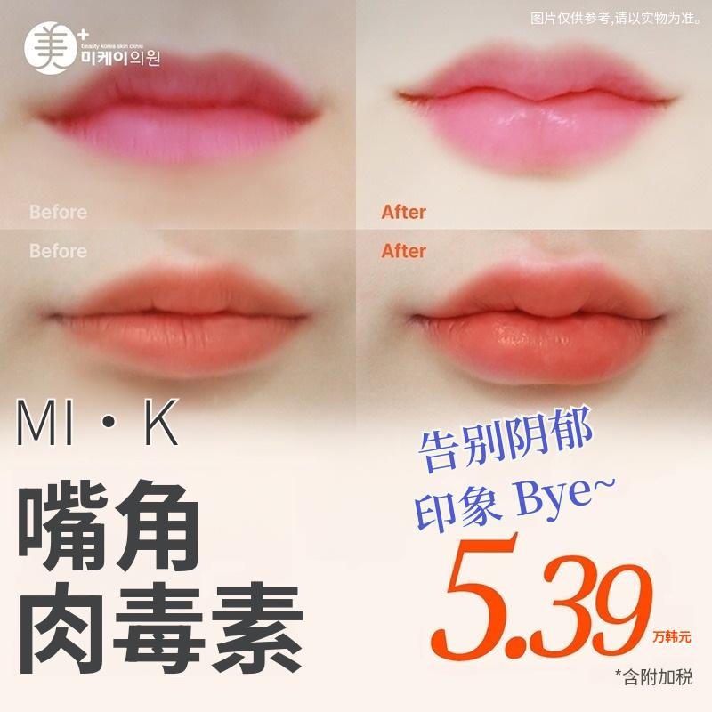 果汁感满满_嘴角肉毒素提升