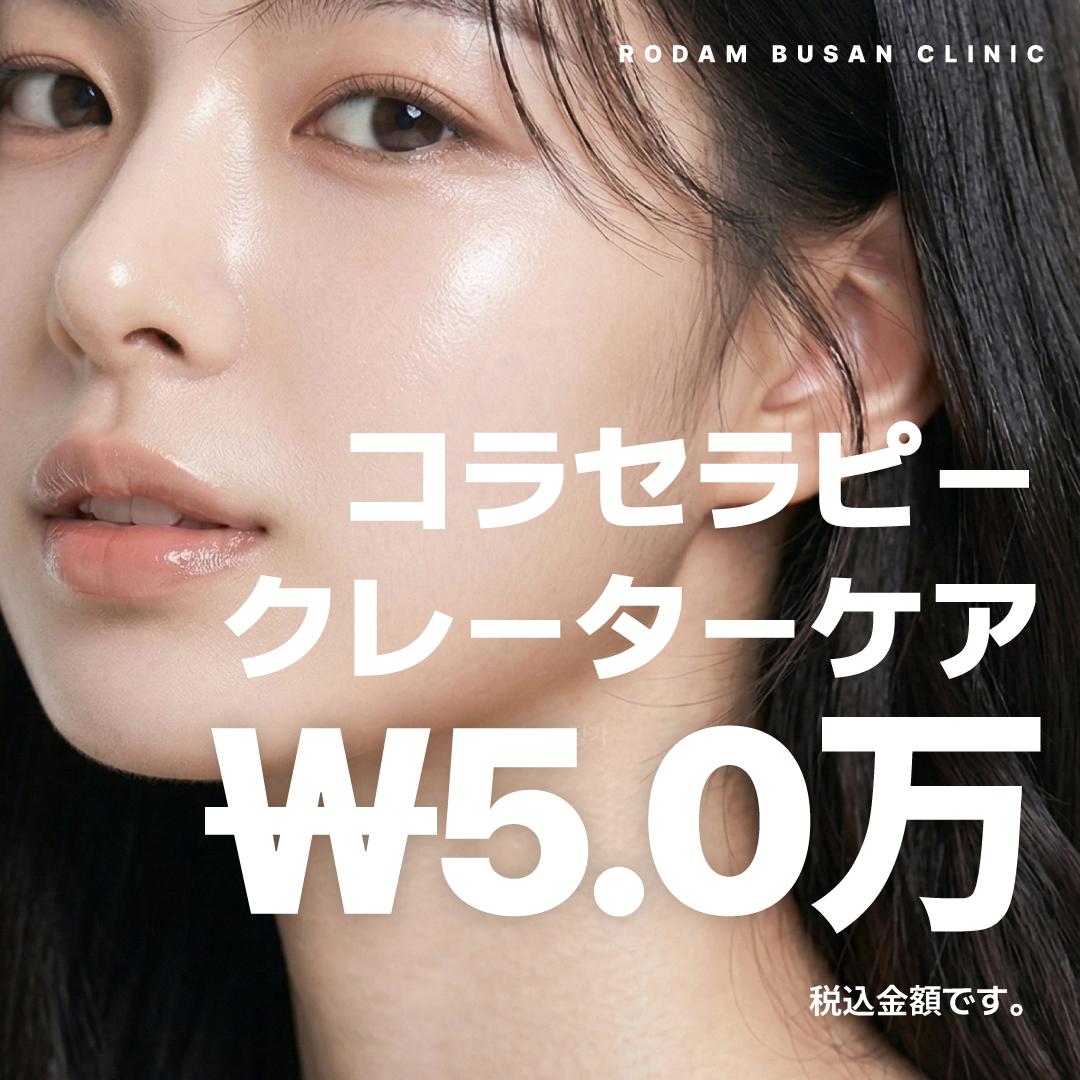 ニキビ跡(クレーター)には [コラセラピー]