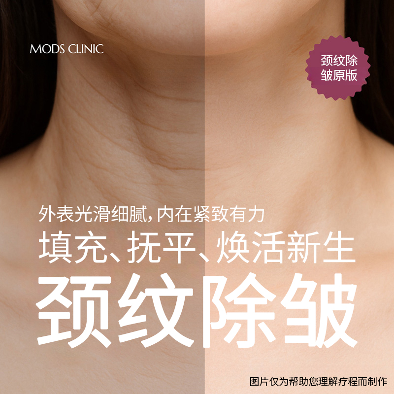 清潭颈纹去除术
