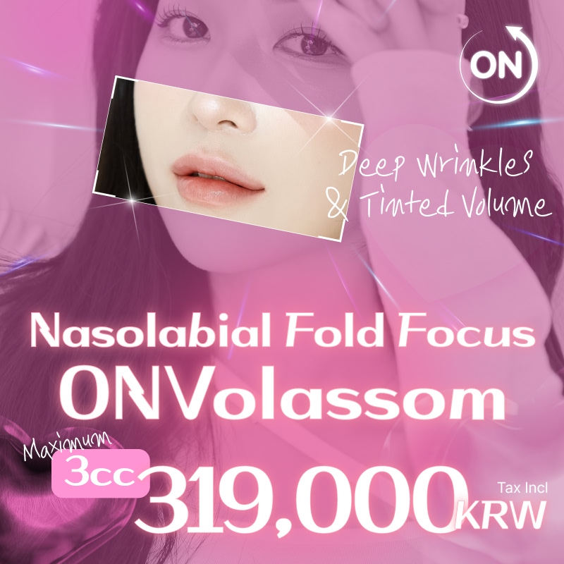 Volume x2 Collagen Nasolabial Fold Lifting – ONVolassom