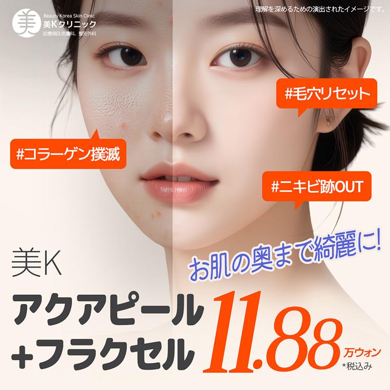 美K モゴンクリア アクアピール フラクセル