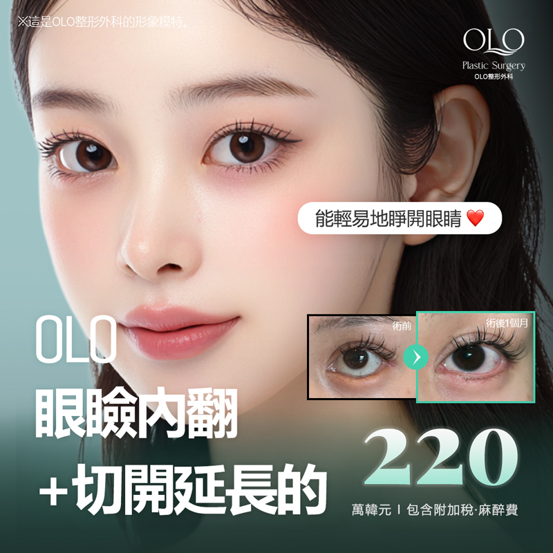 OLO 眼瞼內翻&切開延長 眼瞼內翻校對手術