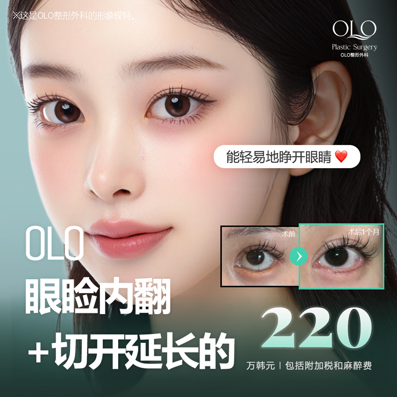 OLO 眼睑内翻&切开延长的 睑内翻倒睫矫正