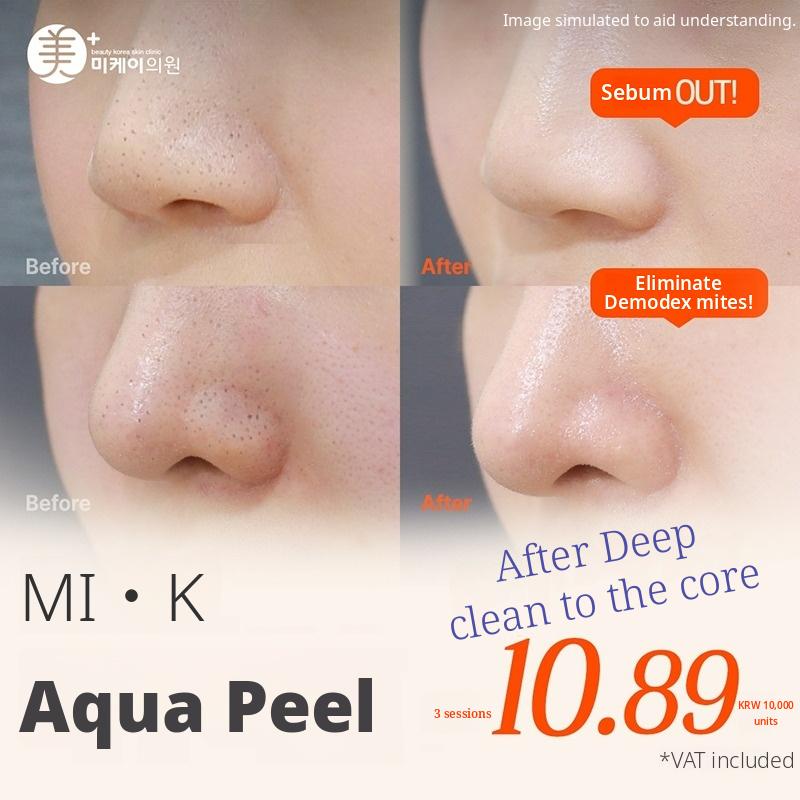 MI.K Aqua Peel 3 Sessions