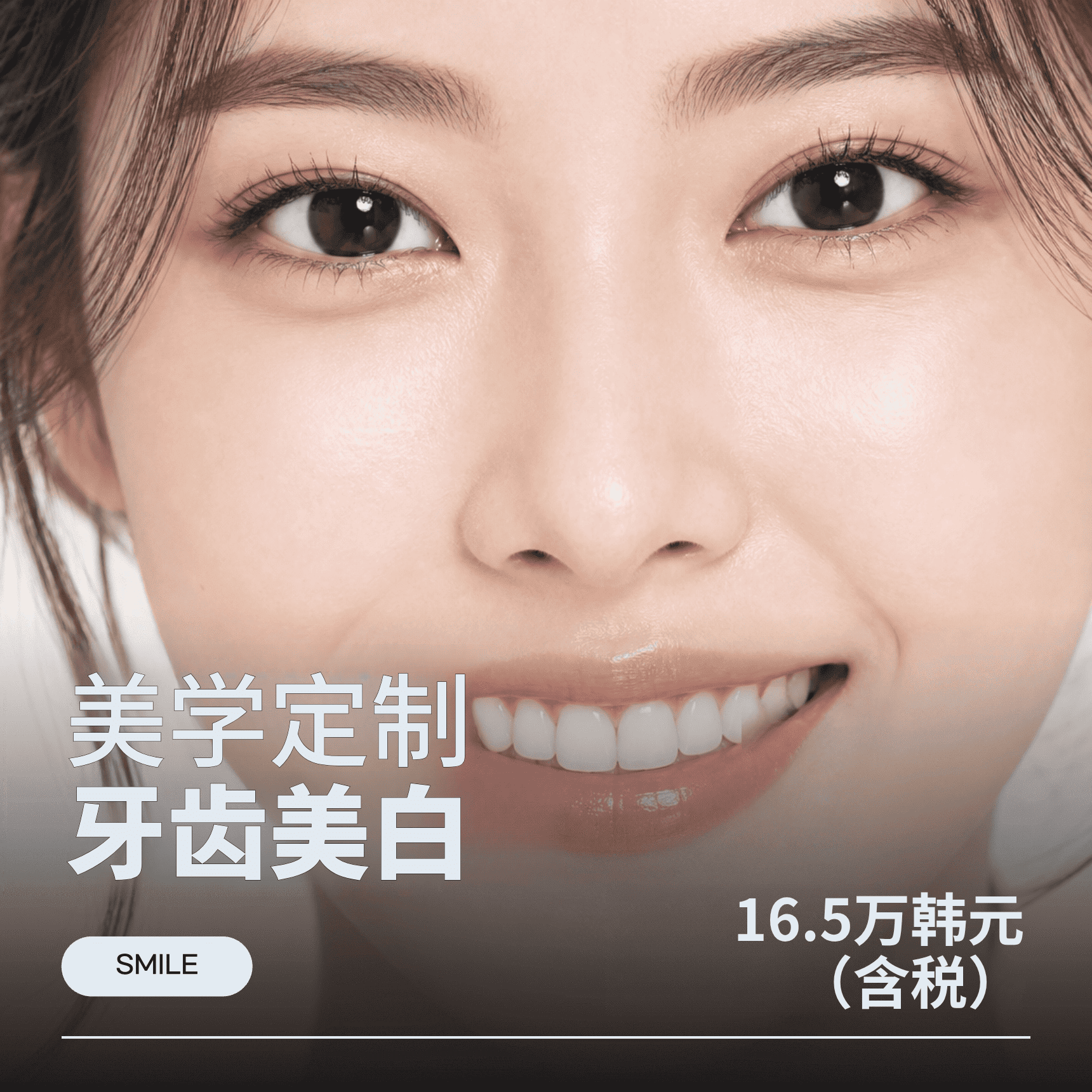 首尔韩医生 牙齿美白 1次