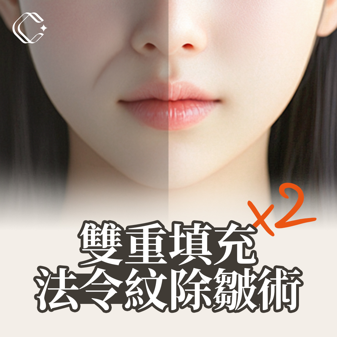 可萊爾 法令紋去除方案