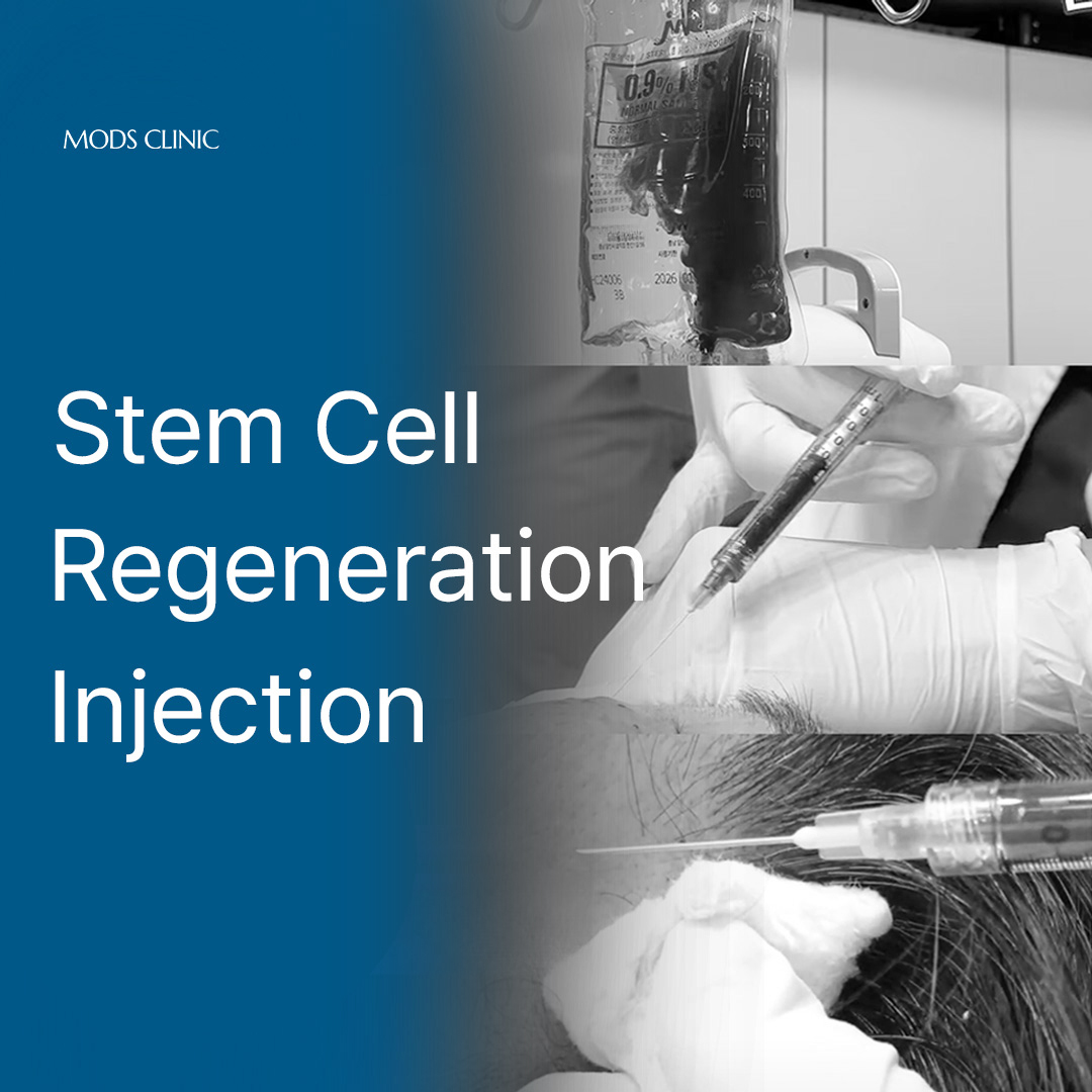 Cheongdam Mods Stem Cell Injection