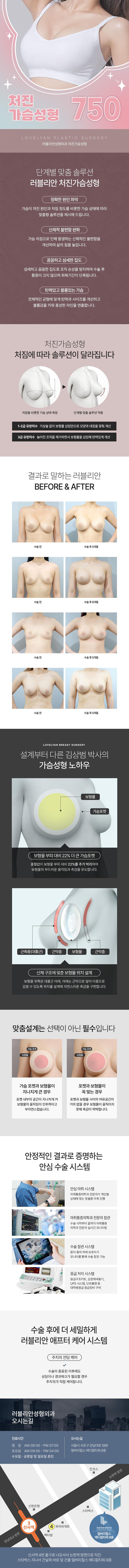 러블리안성형외과의 처진가슴성형 시술로 탄력 개선과 볼륨 회복을 동시에 해결하는 750만원 가격의 프리미엄 시술