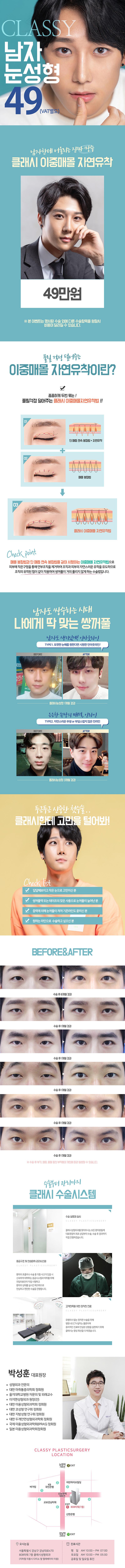 강남역 클래시성형외과의 남자 맞춤형 쌍꺼풀 수술, 49만원 특가로 무쌍에서 인아웃까지 자연스러운 눈매 교정