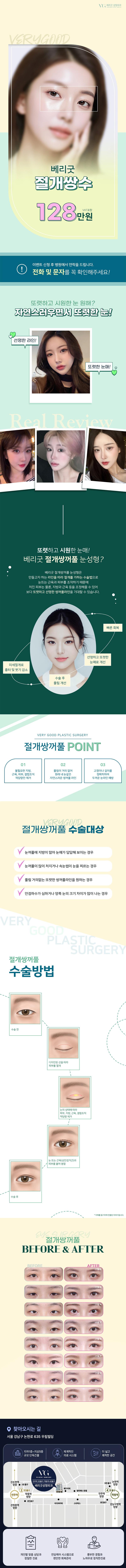 베리굿성형외과의원에서 제공하는 절개 쌍꺼풀 시술