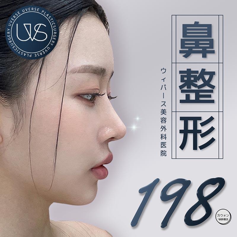 ウィバース 鼻整形