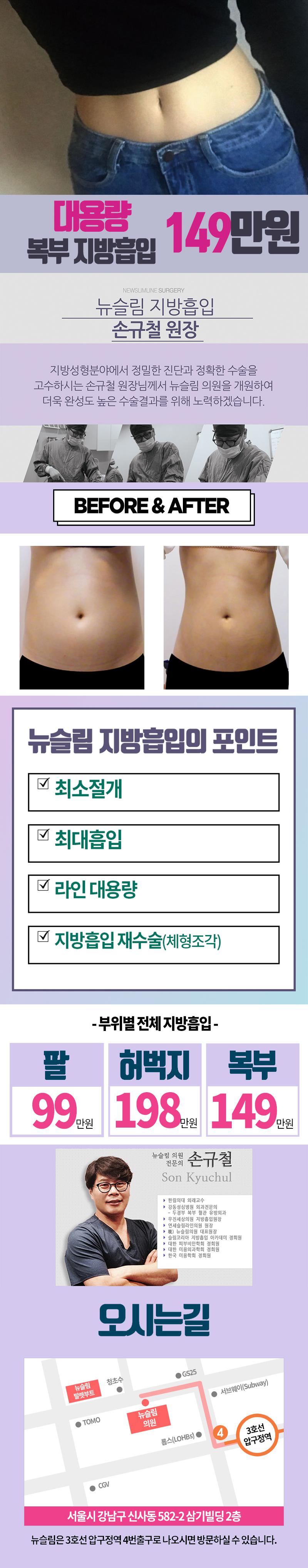 압구정 뉴슬림의원의 대용량 복부 지방흡입 시술, 최소절개로 최대흡입 가능, 149만원 특가 제공