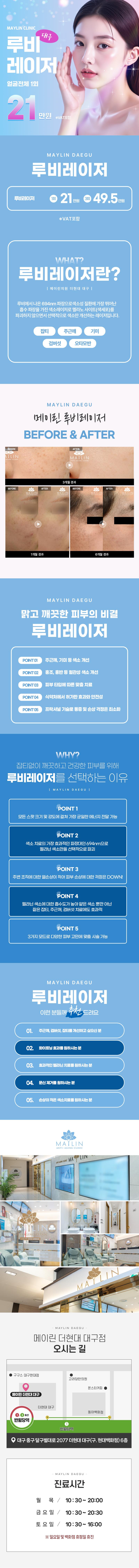 대구 동성로 메이린의원의 기미/주근깨/잡티 개선을 위한 루비레이저 시술 (21만원)