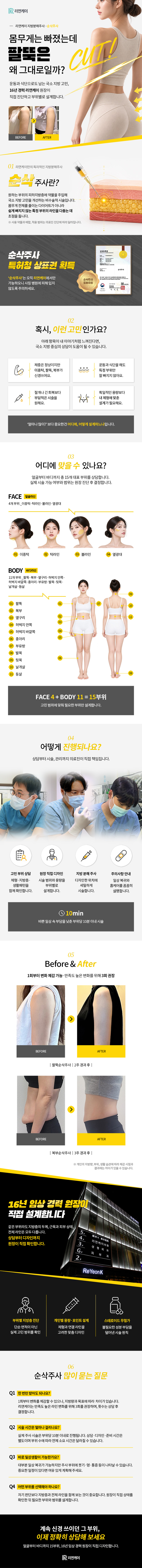 리연케이의원에서 제공하는 NO스테로이드 지방분해와 팔뚝순삭주사 서비스