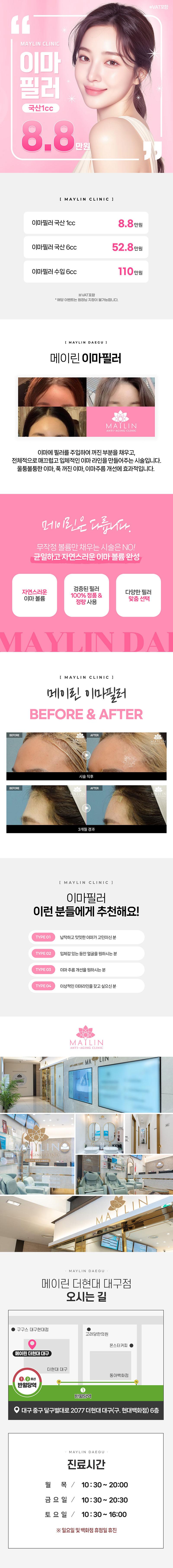 대구 동성로 메이린의원에서 제공하는 8.8만원 대용량 이마필러 시술로 입체적이고 매끄러운 이마라인 완성