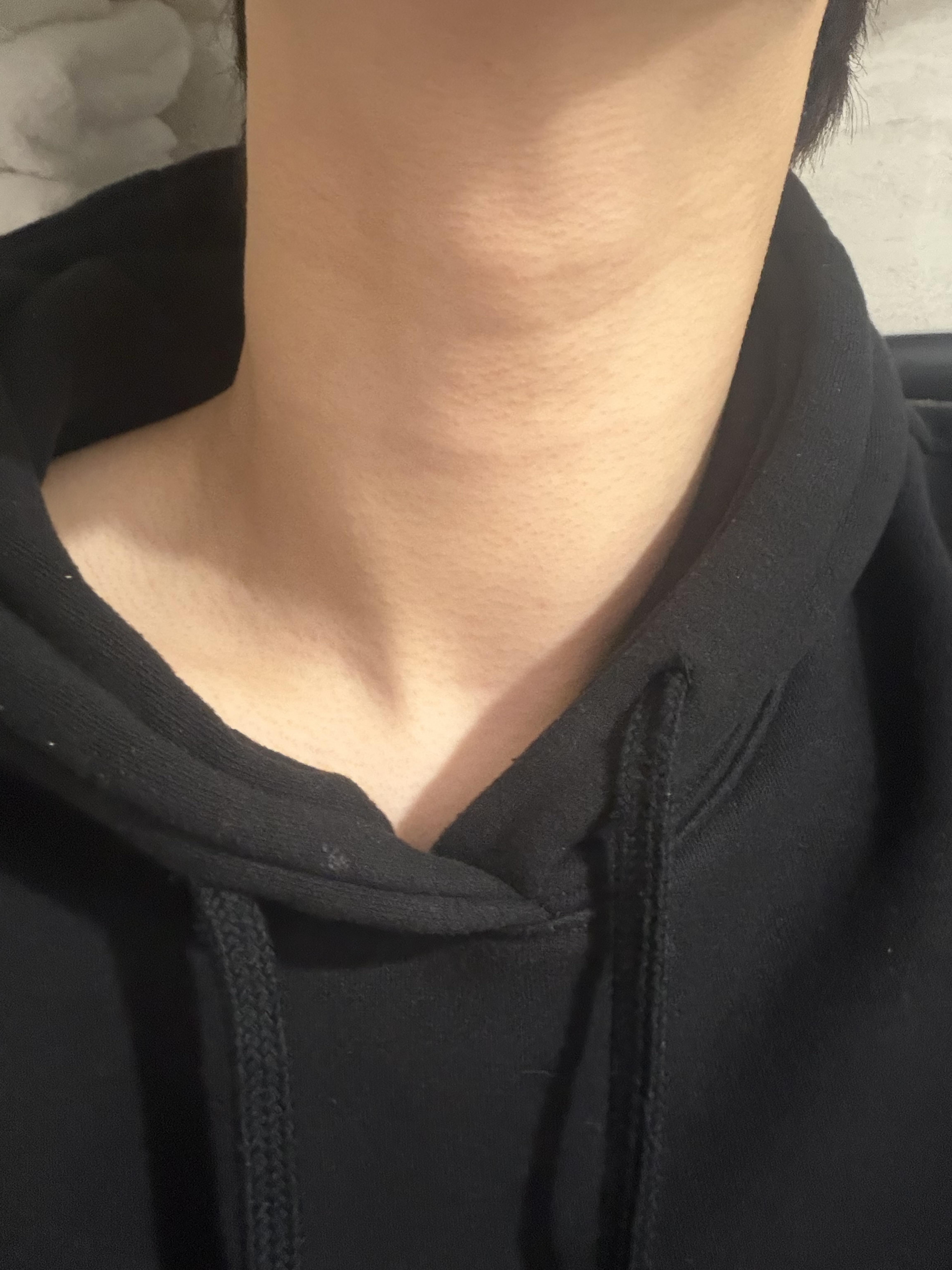 後