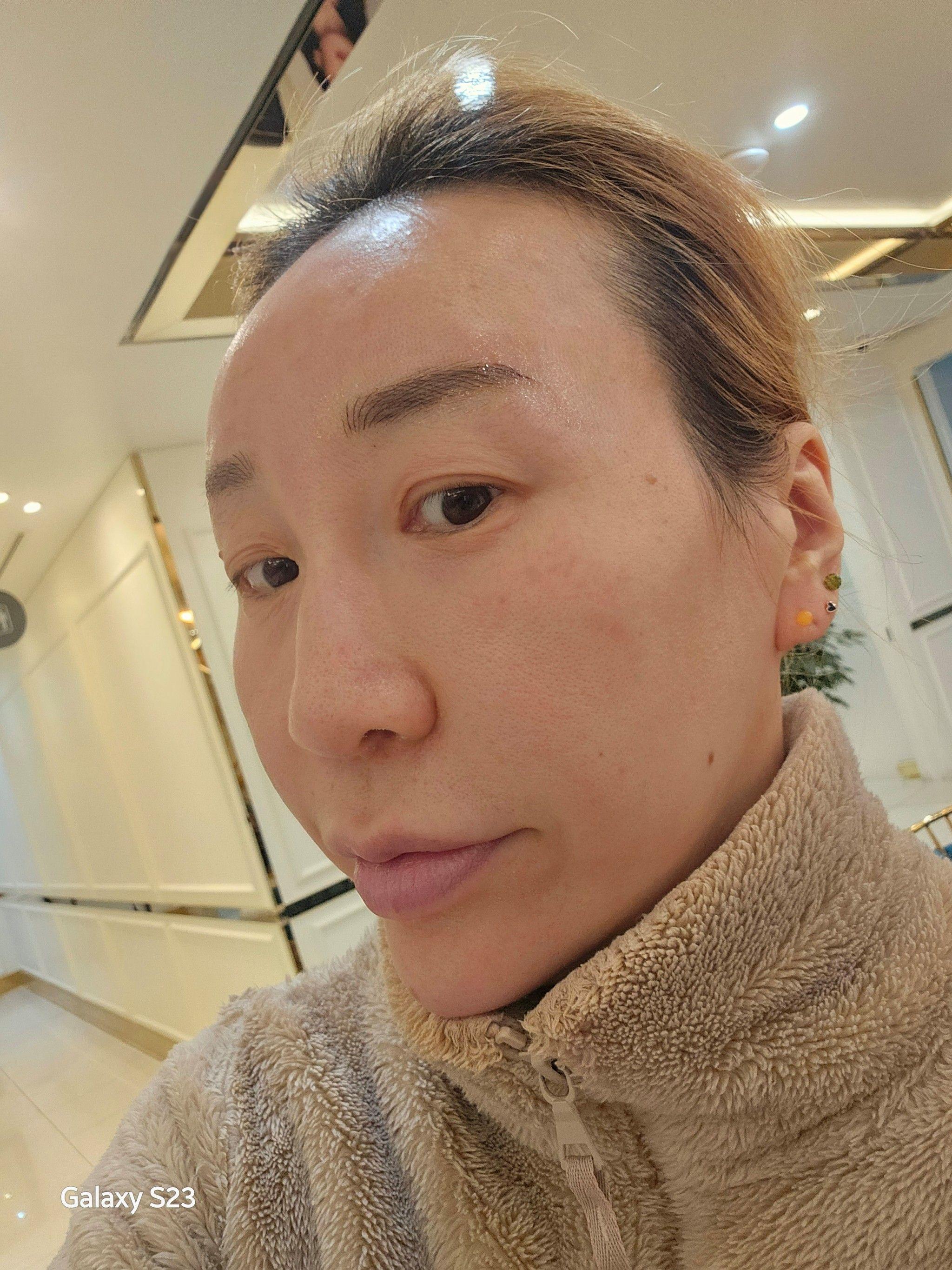後
