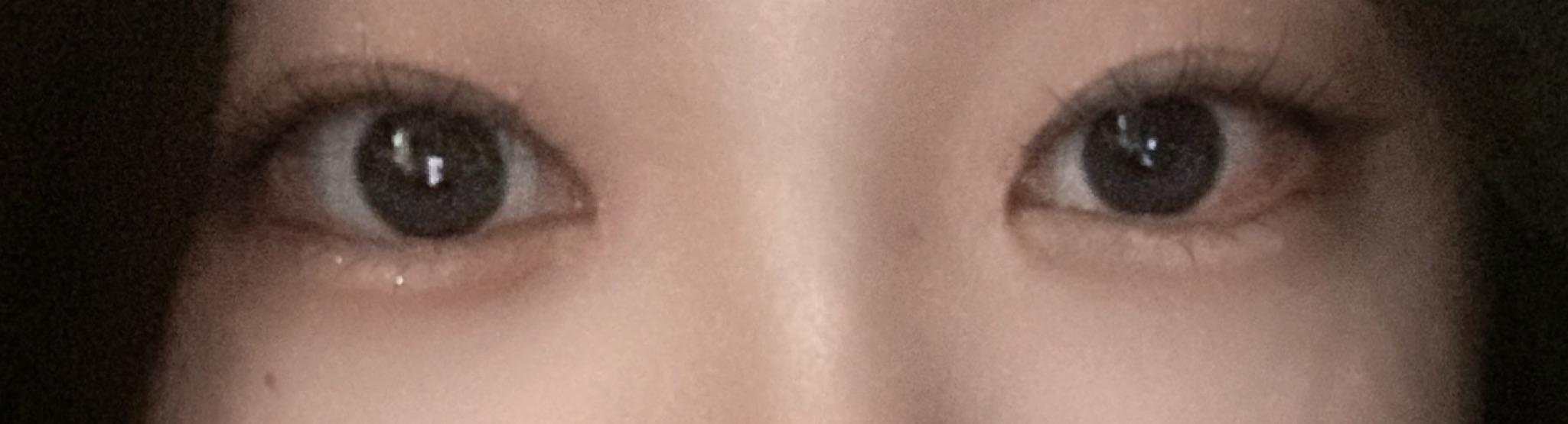 後