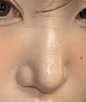 後
