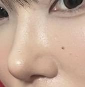 後