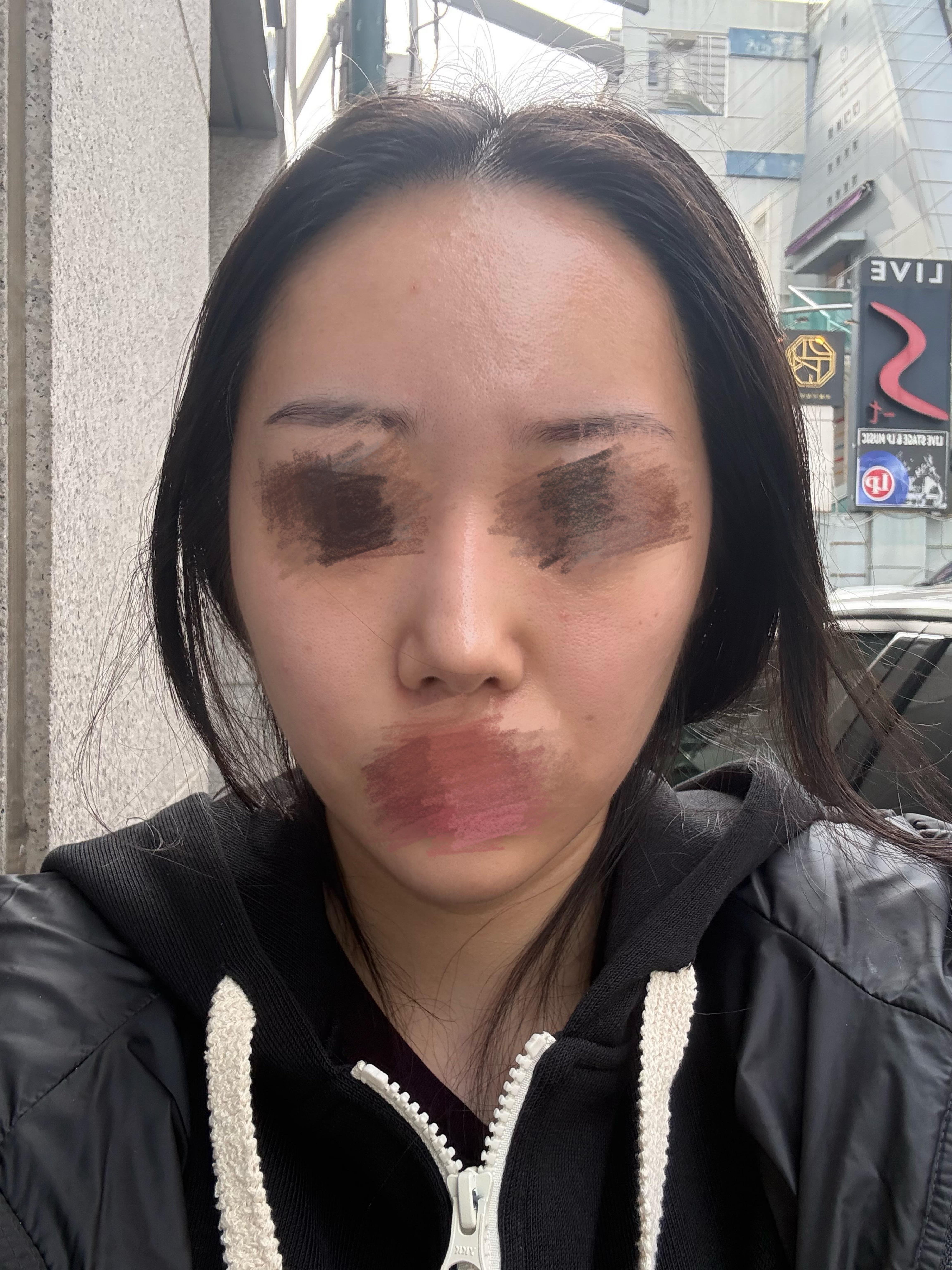 後