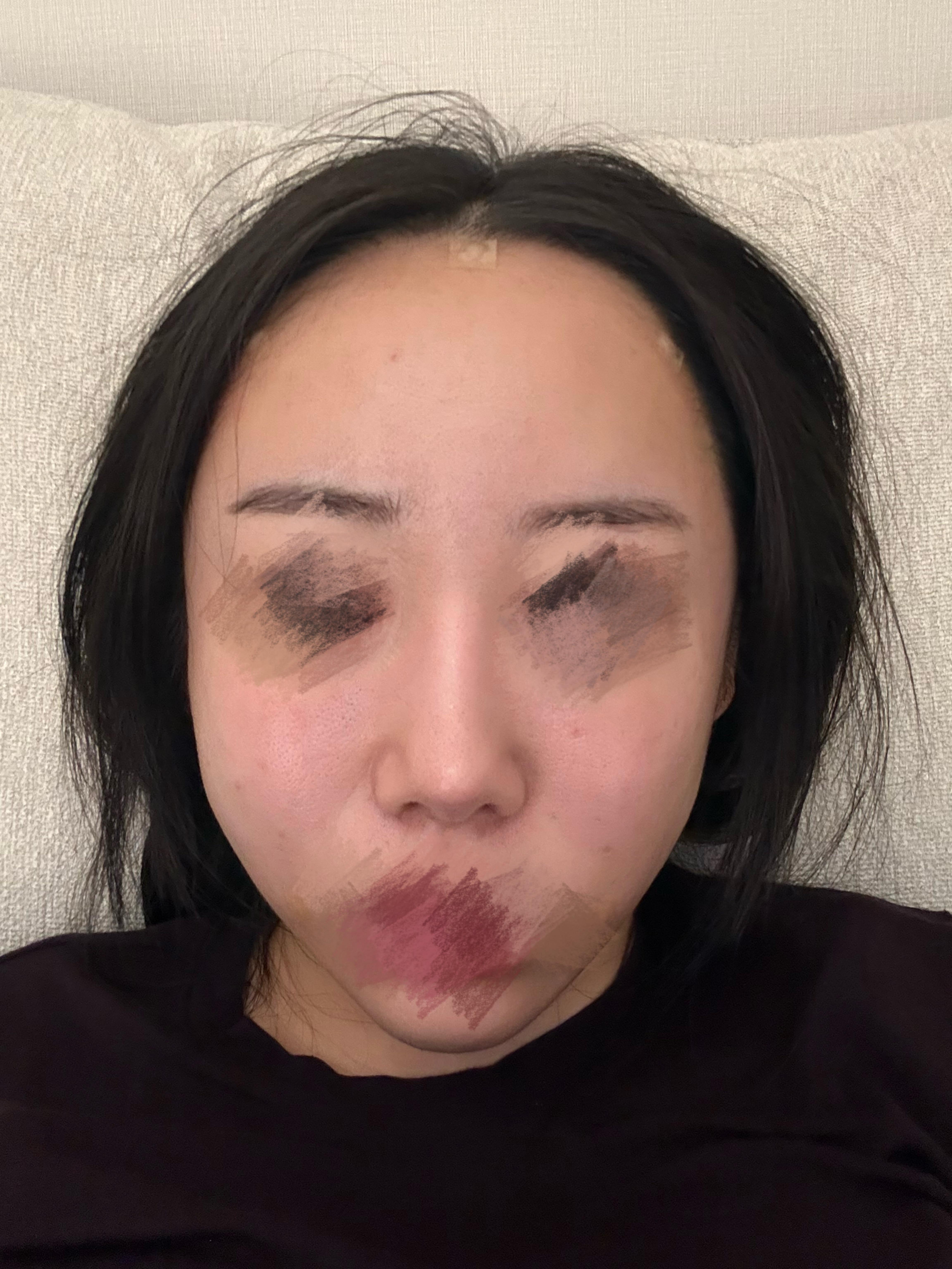後