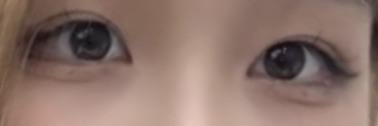 後