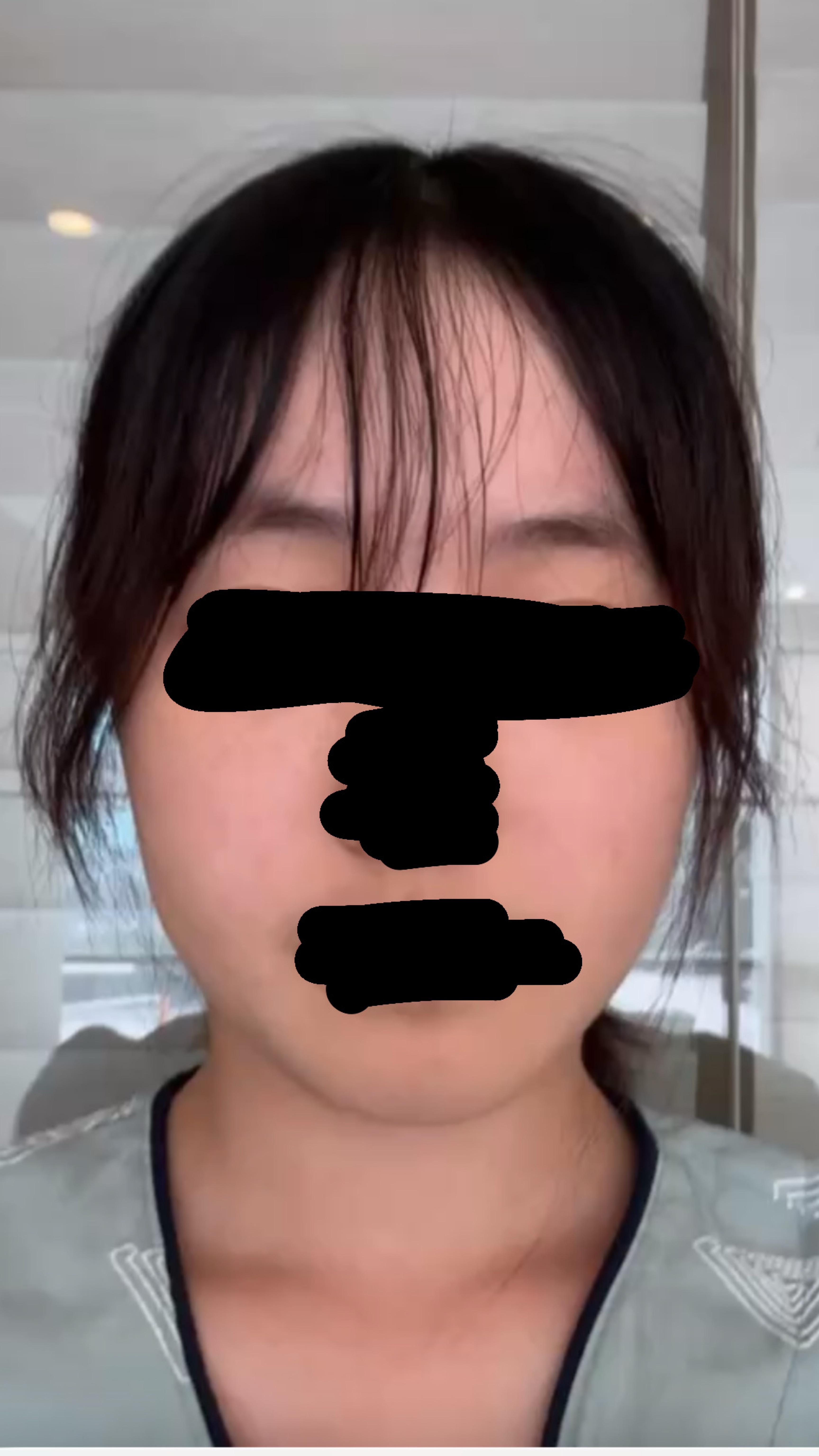 後