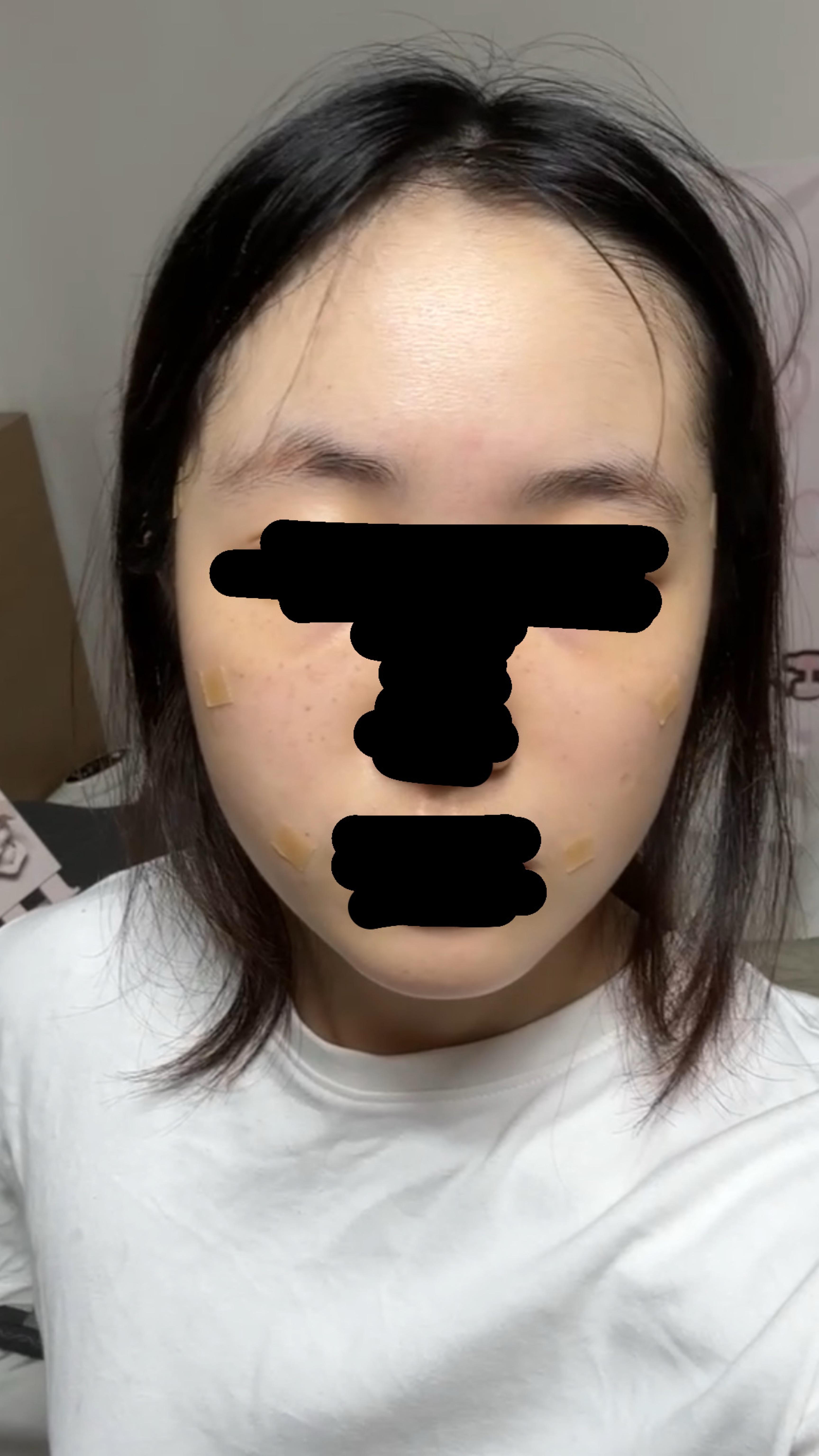 後