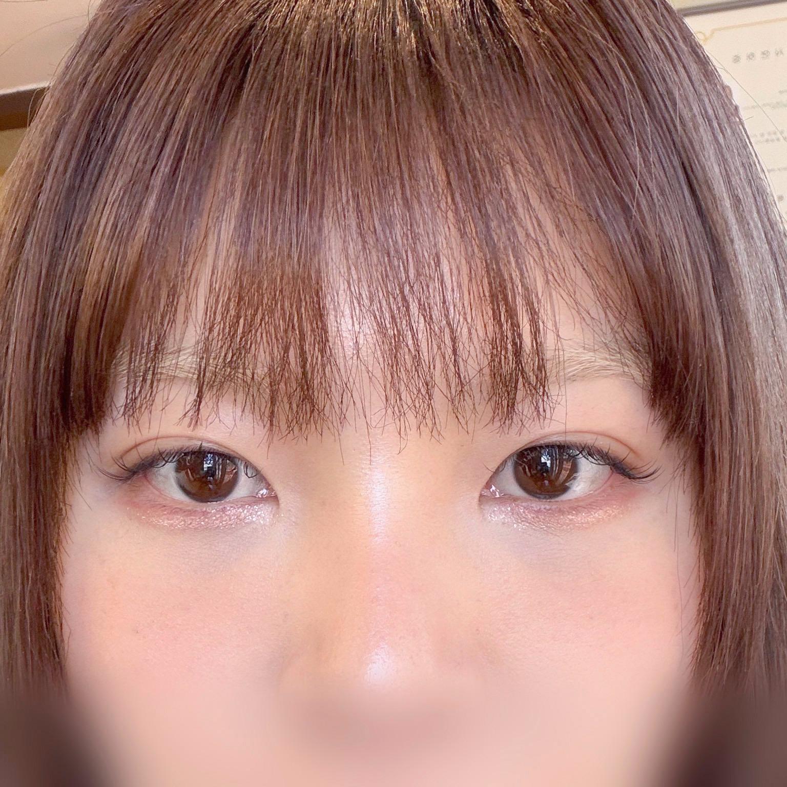 後