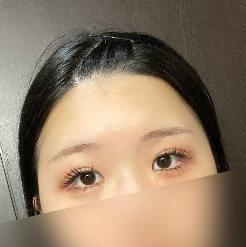 後