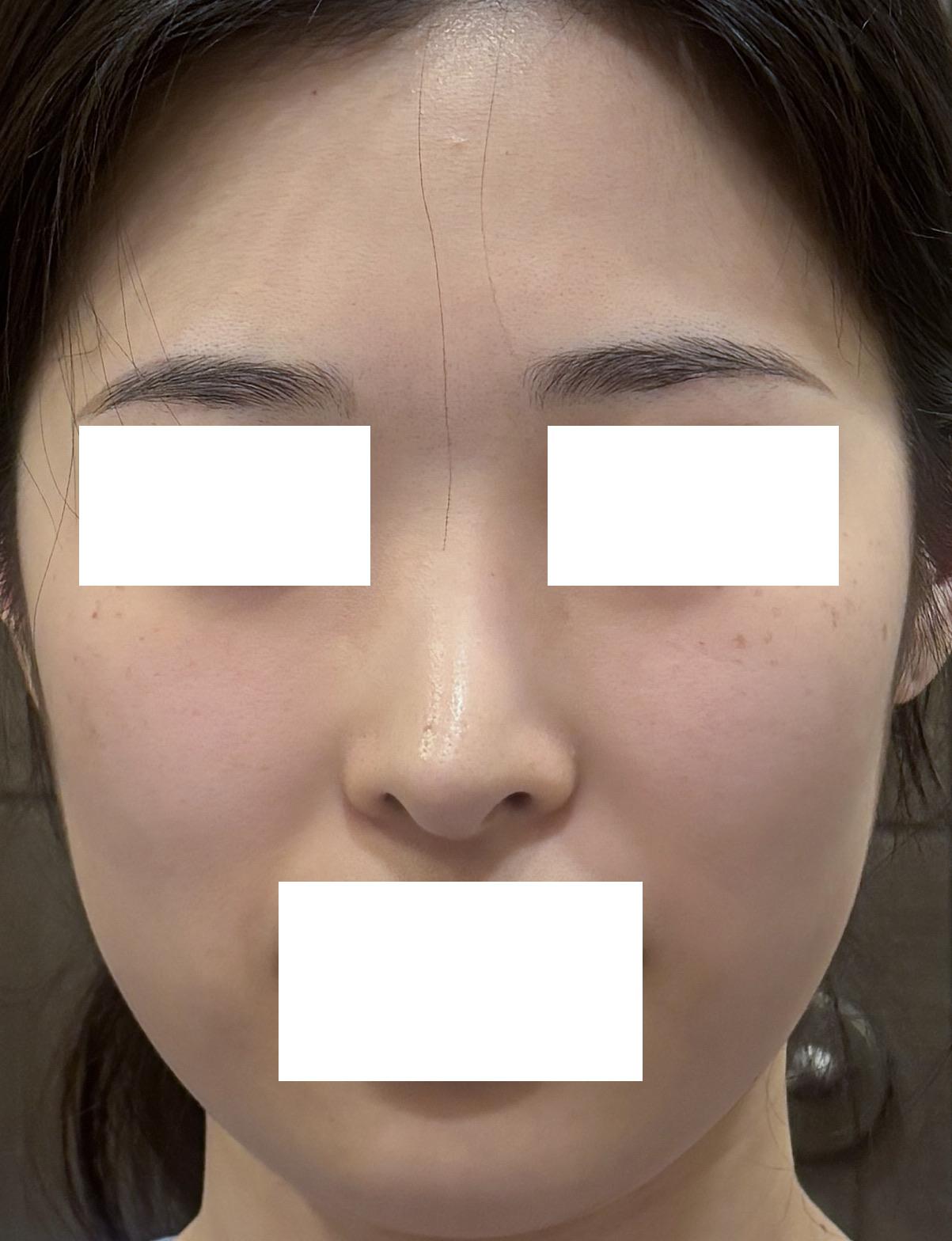 後