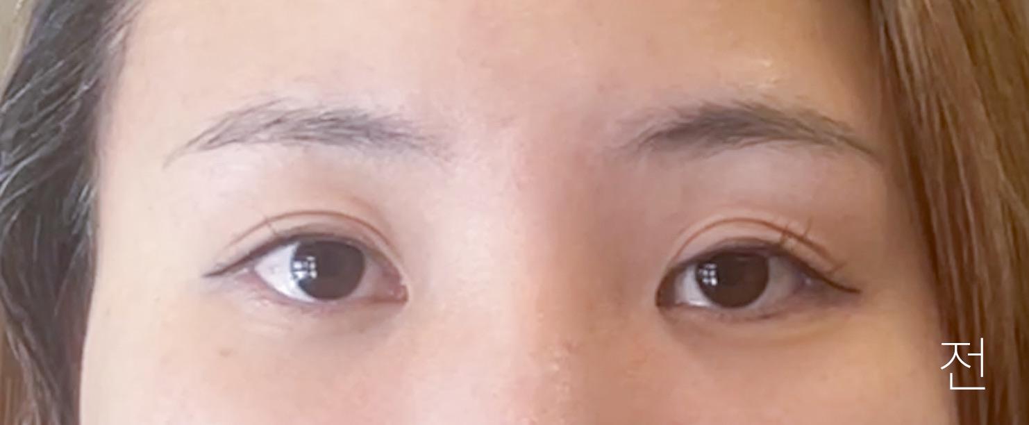 後
