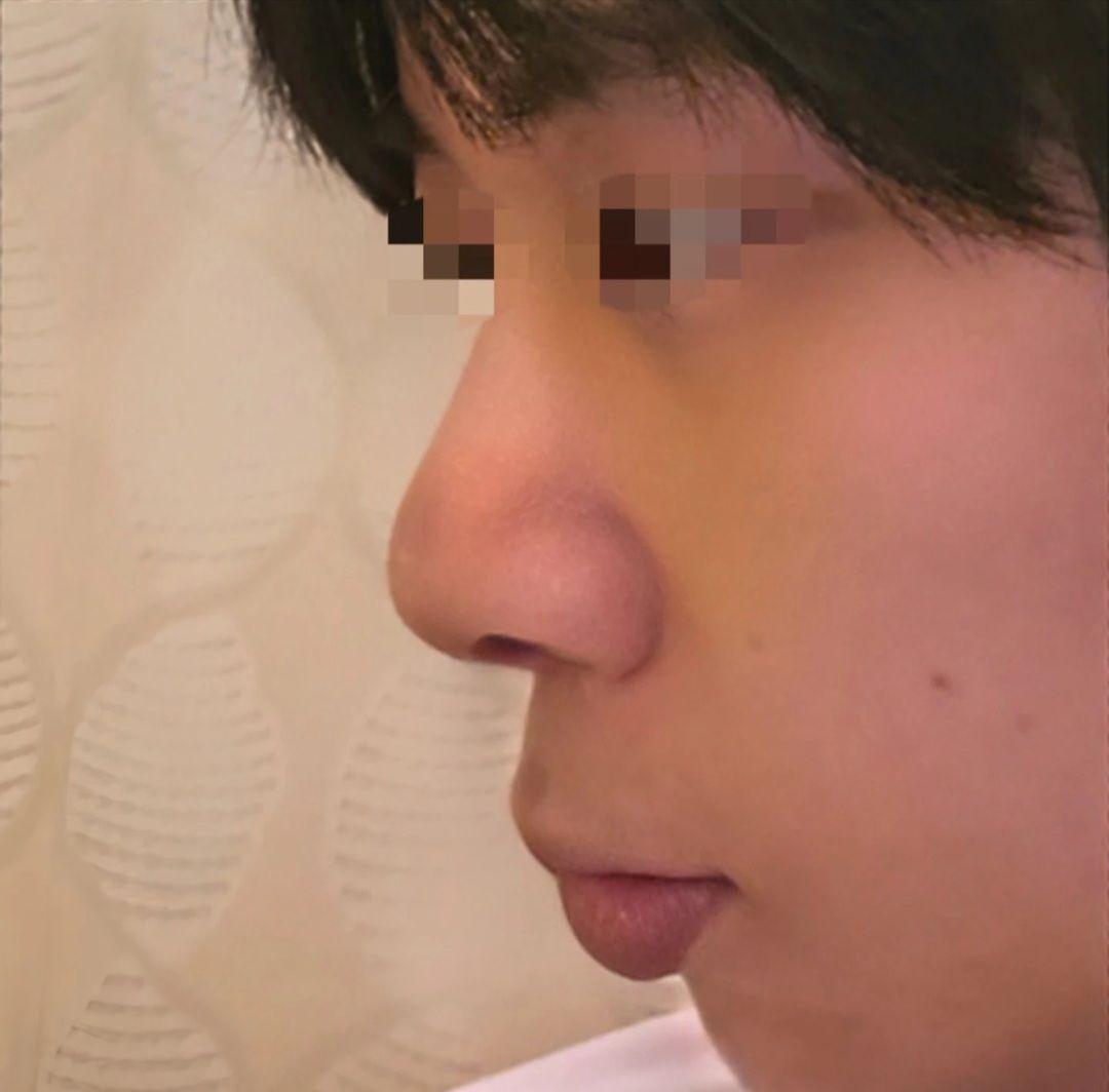 後