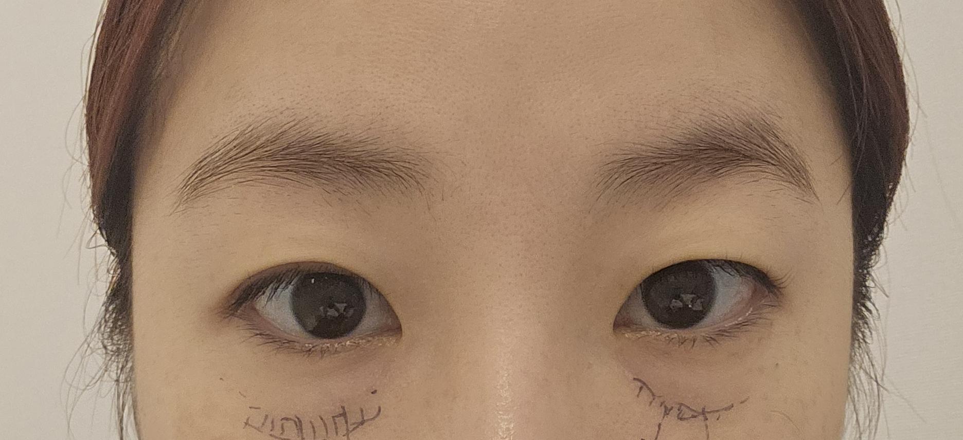 後